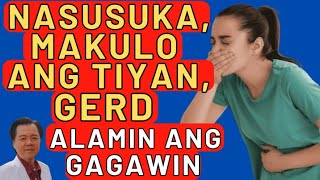 Nasusuka Makulo ang Tiyan GERD Alamin ang Gagawin By Doc Willie Ong [upl. by Tatiana977]