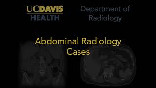 How would you describe this thyroid nodules echogenicity [upl. by Amandi]