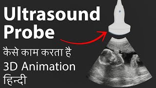 How ultrasound probe works  3D Animation Hindi  Ultrasound Probe कैसे काम करता है [upl. by Ribaj]