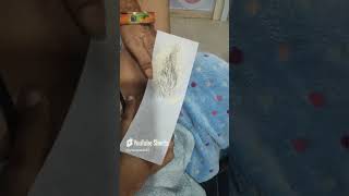 Armpit waxunderarm waxwax stipswaxing hairremovallike and subscriber jyotisaini [upl. by Tristan]