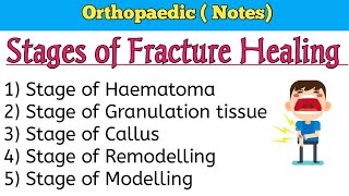 Stages of Fracture Healing [upl. by Eberle]