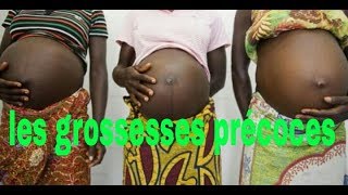 Les grossesses précoces [upl. by Ahtabat]