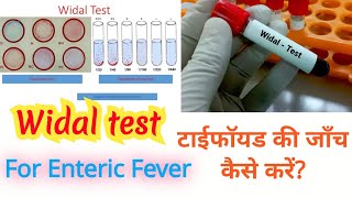 Widal test in hindi [upl. by Adnilim]