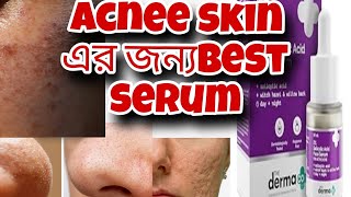 Acne skin এর জন্য Best Serum  acne problem solve dark spot reduction skin repair serum skincare [upl. by Akeber]