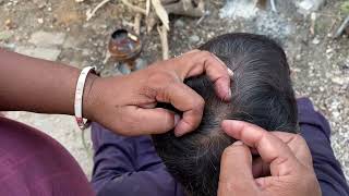 ASMR Wife cleaned husband hair lice [upl. by Burkhart]