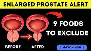 9 Foods You Must Exclude Now for an Enlarged Prostate [upl. by Aidil113]