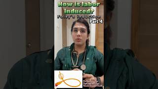 Part 4 Labor induction Artificially starting labor Foley’s induction Mechanical induction [upl. by Sunderland]