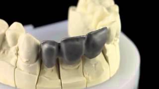 Металл Ceramill Sintron  революция в CADCAM [upl. by Teak634]