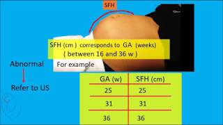 Symphysis Fundal Height  SFH  measurement [upl. by Hamer]