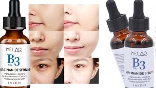 Melao B3 5 Niacinamide Serum Review in Bangla একটি সিরাম ব্যাবহার করে মুখের সব কালো দাগ দূর করুণ [upl. by Joost709]