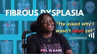 Living With Fibrous Dysplasia [upl. by Ebeohp]