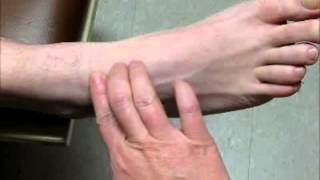 Sample Video  Palpate for Dorsalis Pedis Pulse [upl. by Allisirp340]