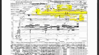 Understanding Clinical Waveforms recorded with the MB Jr  2 of 2avi [upl. by Nihs]