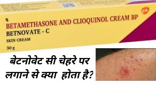 BETNOVATEC Cream  Use  How To Apply  Precautions  Side Effects  PRICE [upl. by Ansilme]