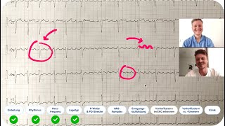 EKG befunden Echtes EKGFallbeispiel mit ärztlicher Auswertung  Kommst du auf die Diagnose [upl. by Norby]