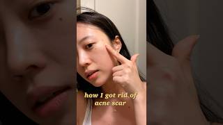 How I got rid of Acne Scar✨ Krave Beauty Great Barrier Relief • Elaband Tea Teee Patch [upl. by Regan167]