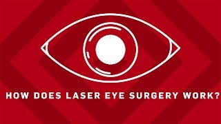 How Does Laser Eye Surgery Work  Earth Science [upl. by Hnah]