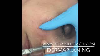 Dermaplaning Technique Face Nose and Mouth [upl. by Nnadroj873]