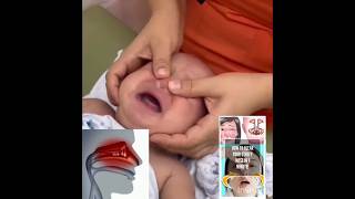 How to clear your stuffy nose in one minute parentingmethod baby [upl. by Aicala634]