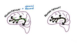 How an Addicted Brain Works [upl. by Shay]