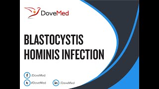 Blastocystis Hominis Infection Blastocystosis Symptoms and Causes  Diagnosis  Treatment [upl. by Spalding691]