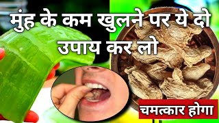 Muh ke kam khulne PR। Submucous Fibrosis । OSMF Treatment In Hindi ।मुंह के कम खुलने का उपाय घर मे । [upl. by Foote]