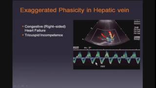 Doppler Ultrasound of the Liver and Portal Hypertension [upl. by Proulx]