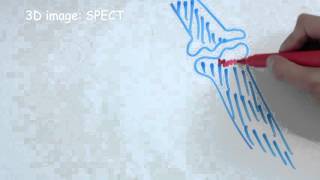 How does bone scintigraphy work [upl. by Slack]