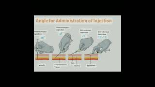 💉How to select angles of administration of injection aiims injection meditutor [upl. by Zanze989]