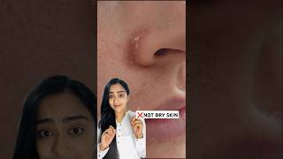 This is not DRY SKIN ❌ but Seborrheic Dermatitis  Heres a simple hack for you [upl. by Orfinger712]