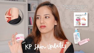 TREATMENT UPDATE FOR KERATOSIS PILARIS  nyobain cream Jepang yang hype buat KP [upl. by Nilre642]