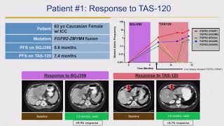 2018 Cholangiocarcinoma Foundation Annual Conference 11  Day 2  FGFR Inhibition [upl. by Notwal226]