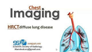 HRCT of diffuse lung disease II DRE Prof Mamdouh Mahfouz [upl. by Enitsirk684]