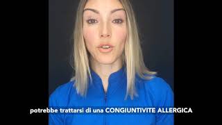 Congiuntivite allergica [upl. by Lleval]