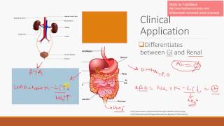 Urine Anion Gap [upl. by Derreg]