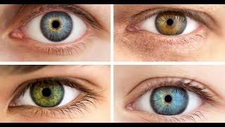 Why do some people have different colored eyes Facts you don’t know about eye color [upl. by Ellenuahs]