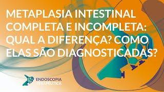 Metaplasia intestinal completa e incompleta qual a diferença Como elas são diagnosticadas [upl. by Grata]