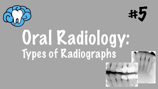 Oral Radiology  Types of Radiographs  INBDE ADAT [upl. by Bland]