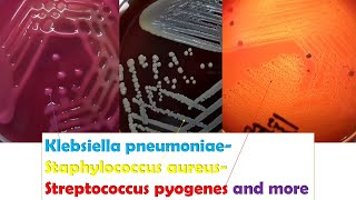 KlebsiellaStaphylococcus Betahaemolytic Streptococci Enterococcus Serratia Micrococcus [upl. by Vatsug]