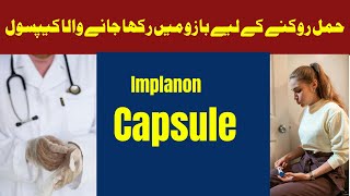 Waqfa ka Tarika  Hamal Rokne Ka Tarika  Control Pregnancy by Implant Capsule [upl. by Reivad]