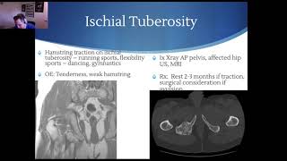 Apophyseal injuries in sport Part 2 [upl. by Seve]