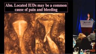 Ultrasound First and Imaging of the Pelvis  Beryl Benacerraf MD [upl. by Venuti]