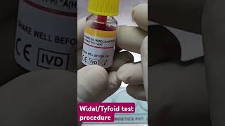 WIDAL TYFOID complete test procedure [upl. by Hselin]