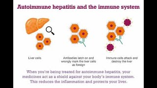 Autoimmune Hepatitis  Definition causes symptoms Diagnosis Treatment [upl. by Eilagam]