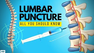 Lumbar Puncture Everything You Need to Know [upl. by Haelahk]