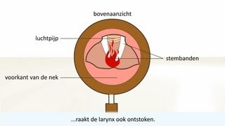 Keelontsteking  de oorzaak en behandeling [upl. by Ahseinat314]