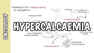 Hypercalcemia in malignancy  causes pathophysiology symptoms treatment [upl. by Limemann312]