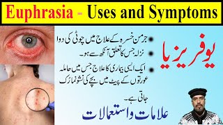 euphrasia 30 200 1M1000 homeopathic medicine uses in HindiUrdu  euphrasia homeopathy uses [upl. by Eleazar]