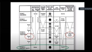 HISTORIA DE LA ANESTESIOLOGIAEVALUACION PREANESTESICA Y FARMACOS ANESTESICOS GENERALES INHALATORIOS [upl. by Aremat692]