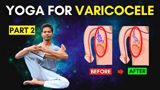 Varicocele Exercises Part 2 Follow Along At Home  Yoga for Varicocele varicocele [upl. by Wiseman]